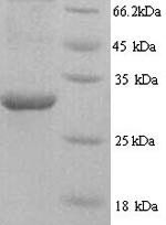HNRNPL protein (HNRNPL), partial, human, recombinant