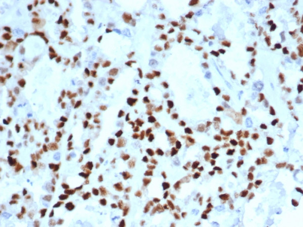 Anti-Cyclin E (G1/S-Phase Cyclin), recombinant antibody, clone CCNE1/4935R