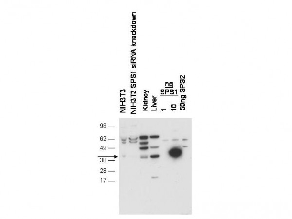Anti-Selenophosphate Synthetase 1 (SPS1)