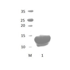MAGI2_5 PDZ Domain