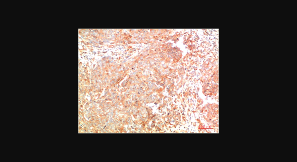 Anti-ATG7 (3D6), monoclonal