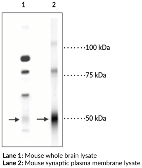 Anti-GABAA Receptor delta-subunit (N-Term)