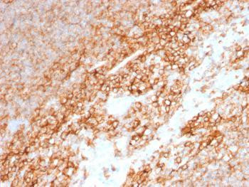 Anti-CD44 / HCAM Std. Monoclonal Antibody (Clone: BU75)