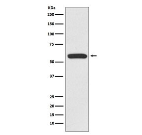 Anti-IRF6 / Interferon Regulatory Factor 6, clone GHD-9