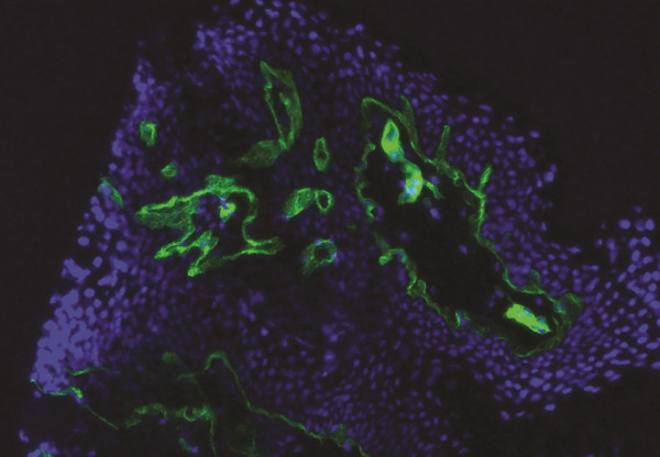 Anti-Collagen IV, clone 2F11