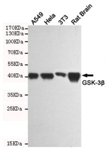 Anti-GSK3 beta / GSK3B, clone 2E6-D6-C12