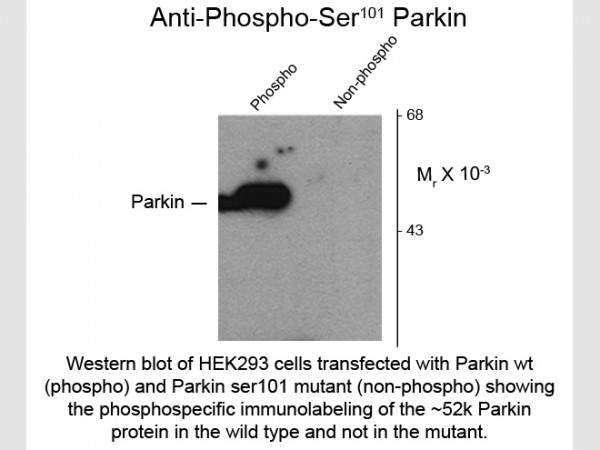 Anti-phospho-Parkin (Ser101)