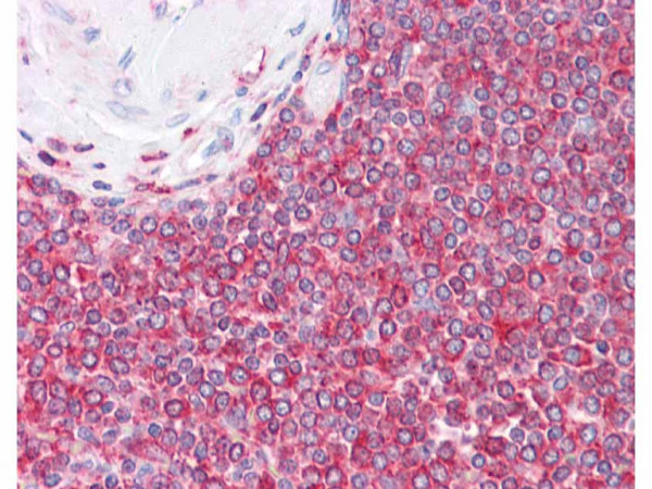 Anti-Actin, beta, clone 3H2.E4.E12