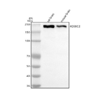 Anti-IQSEC2 / IQ motif and Sec7 domain-containing protein 2