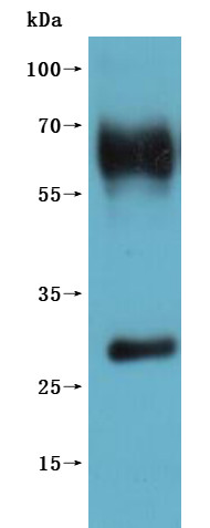 G-protein coupled receptor 20 (GPR20)-VLPs (Active), recombinant human