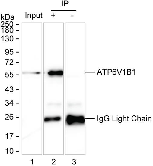 Anti-ATP6V1B1