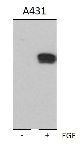 Anti-phospho-STAT1 (Tyr701), clone SM1351
