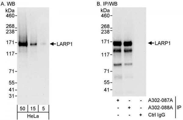 Anti-LARP1