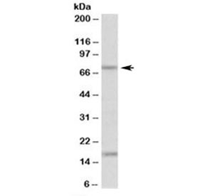 Anti-TGM7