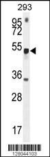 Anti-METTL4, CT (METTL4, Methyltransferase-like protein 4)
