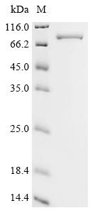 Tyrosine-protein kinase ZAP-70 (ZAP70), human, recombinant