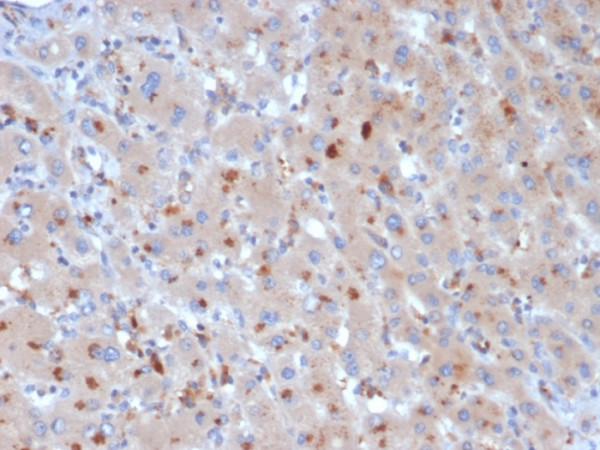 Anti-Alpha-1-Antichymotrypsin (SERPINA3) (Histiocytoma Marker), clone SERPINA3/4190