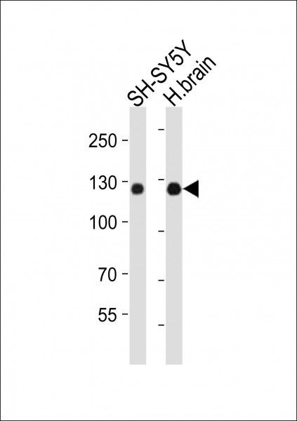 Anti-Amphiphysin / AMPH