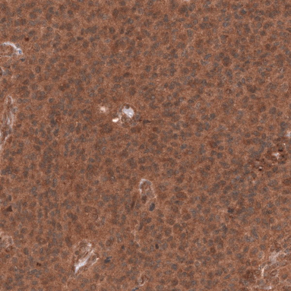 Anti-ABCB5, clone CL13628