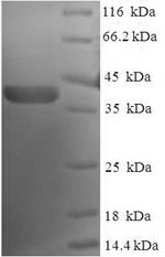 Nucleolar protein 3 (NOL3), human, recombinant
