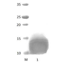 NHERF4_1 PDZ Domain