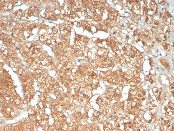 Anti-ATM / ATM serine / threonine kinase, clone ATM/9472