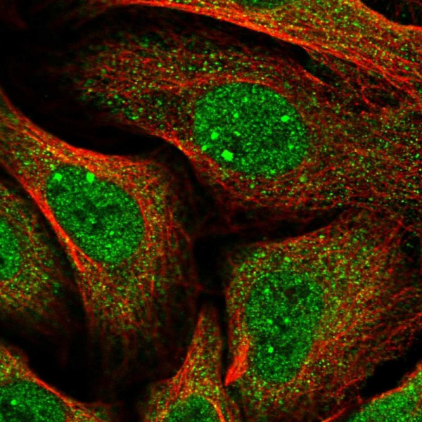 Anti-HGH1