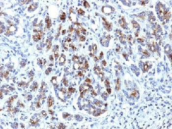 Anti-alpha 1 Antichymotrypsin, clone AACT/1451