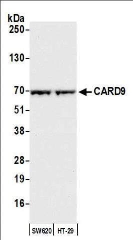 Anti-CARD9