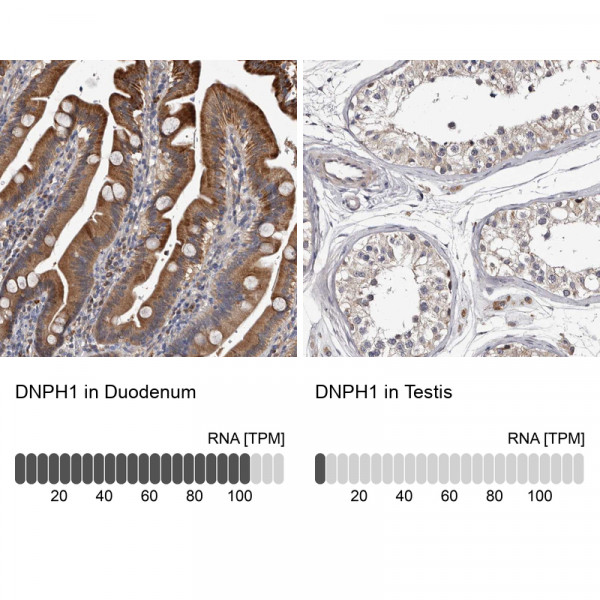 Anti-DNPH1