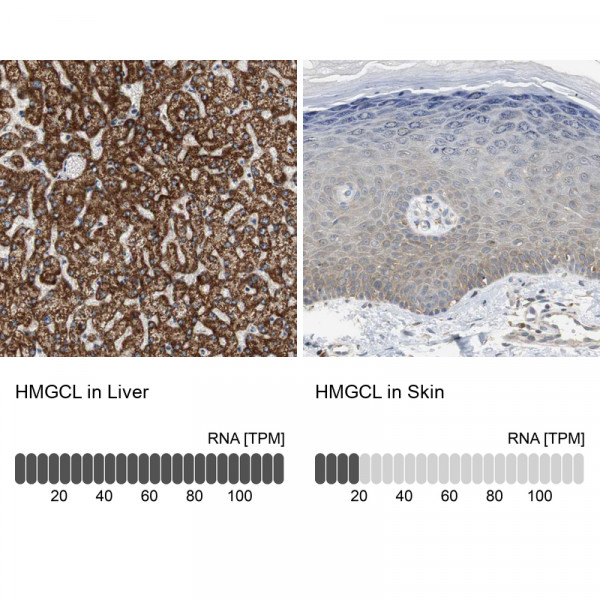 Anti-HMGCL