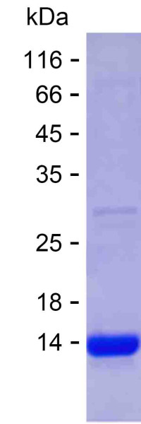 ALK (human), recombinant protein