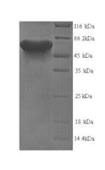 Leucine-rich repeat and immunoglobulin-like domain-containing nogo receptor-interacting protein 1 (L