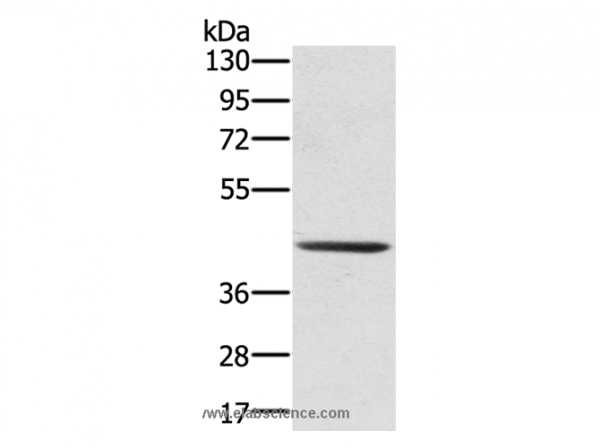 Anti-SCPEP1