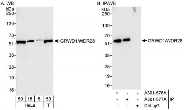 Anti-GRWD1/WDR28