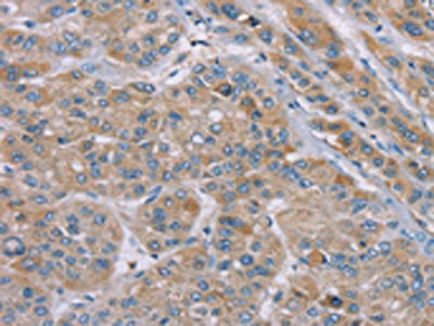 Anti-SAMD9