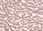 Anti-SerpinD1 Monoclonal Antibody