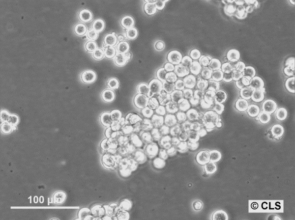 SK-MEL-1 Cells