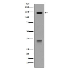 Anti-LDLR / LDL Receptor, clone BFC-12