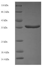Protein phosphatase 1B (PPM1B), human, recombinant