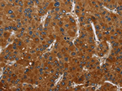 Anti-CSH1