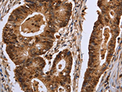 Anti-EXTL3