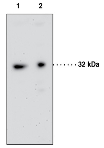 Anti-GPCR GPR35