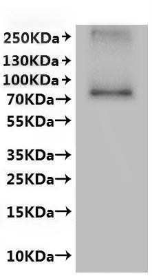 Transient receptor potential cation channel subfamily V member 6 (TRPV6)-VLPs, recombinant human