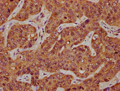 Anti-CD164