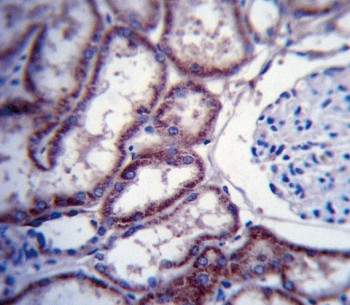 Anti-FER / Tyrosine-protein kinase Fer