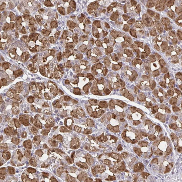 Anti-MDH1