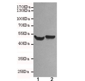 Anti-NSE / Neuron Specific Enolase, clone 1H8-B4