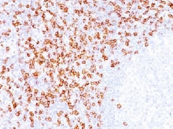 Anti-CD8, clone C8/144B
