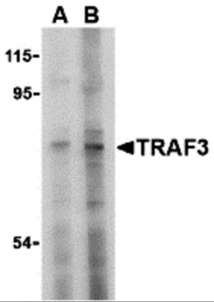 Anti-TRAF3
